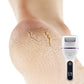 Portable Electric Foot Callus Remover - Quick & Efficient Dead Skin Removal